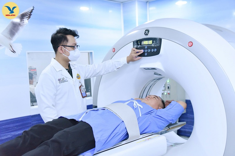 Người có tiền sử hút thuốc lá lâu năm có thể được bác sĩ tư vấn chụp CT liều thấp để tầm soát ung thư phổi. 