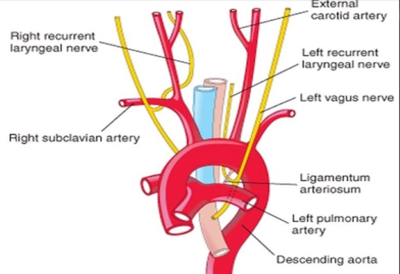 Sơ đồ giải phẫu đường đi của dây thần kinh thanh quản quặt ngược trái