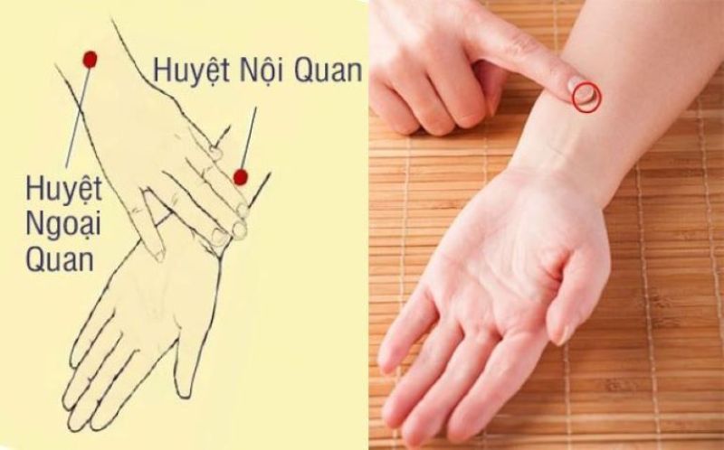 Huyệt nội quan nằm ở chính giữa khe giữa hai gân cơ
