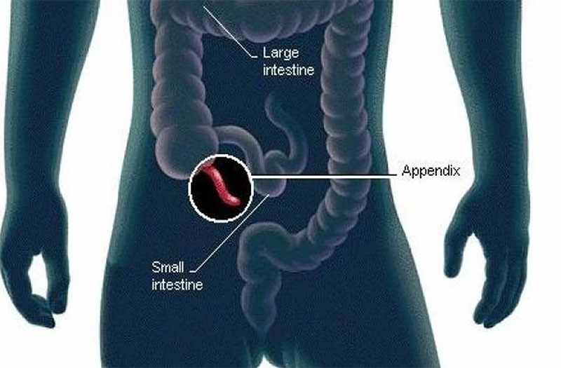 Cơn đau ruột thừa thường bắt đầu từ vị trí nào trên cơ thể?
