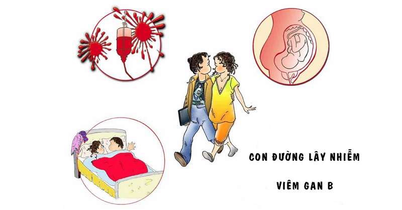 Con đường lây nhiễm viêm gan B