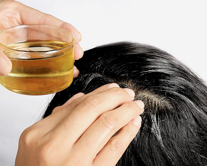 Những điều cần biết về chứng bị tóc bị nấm da đầu và lợi ích của nó