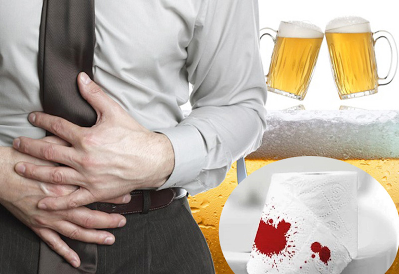 Tình nóng của rượu bia có thể làm táo bón và gây ra xuất huyết tiêu hóa không?
