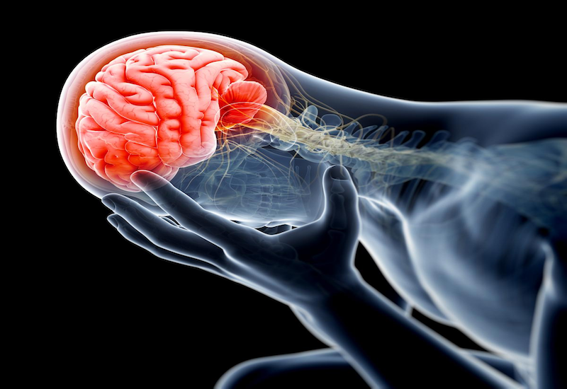 Điều trị như thế nào cho một bệnh án đột quỵ nhồi máu não?
