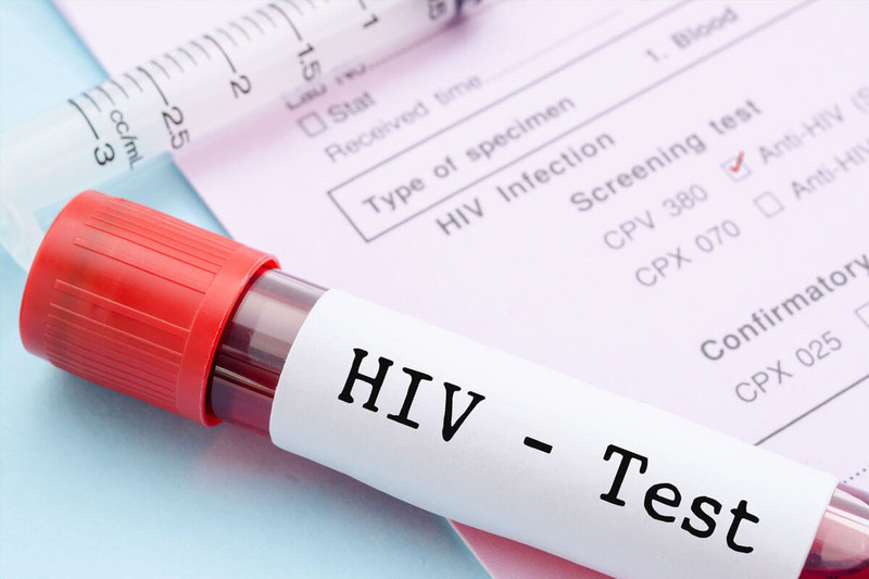 Cách sử dụng que thử hiv bằng nước bọt để kiểm tra hiệu quả