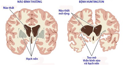 7. Cách phòng ngừa bệnh hủi