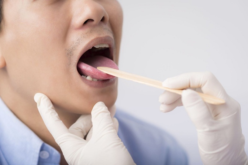 Rát lưỡi và đau họng có thể xuất hiện đồng thời hay lần lượt?
