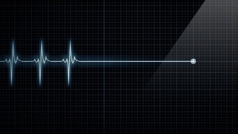Hiểu về dấu hiệu ngừng tim ngừng thở và cách xử lý trong tình huống khẩn cấp