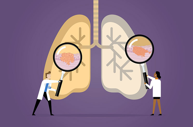 Làm thế nào để xác định nếu một người có di truyền ung thư phổi hay không?
